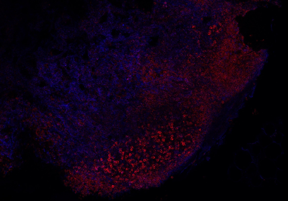 Human CXCL13/BLC/BCA‑1 Antibody AF801