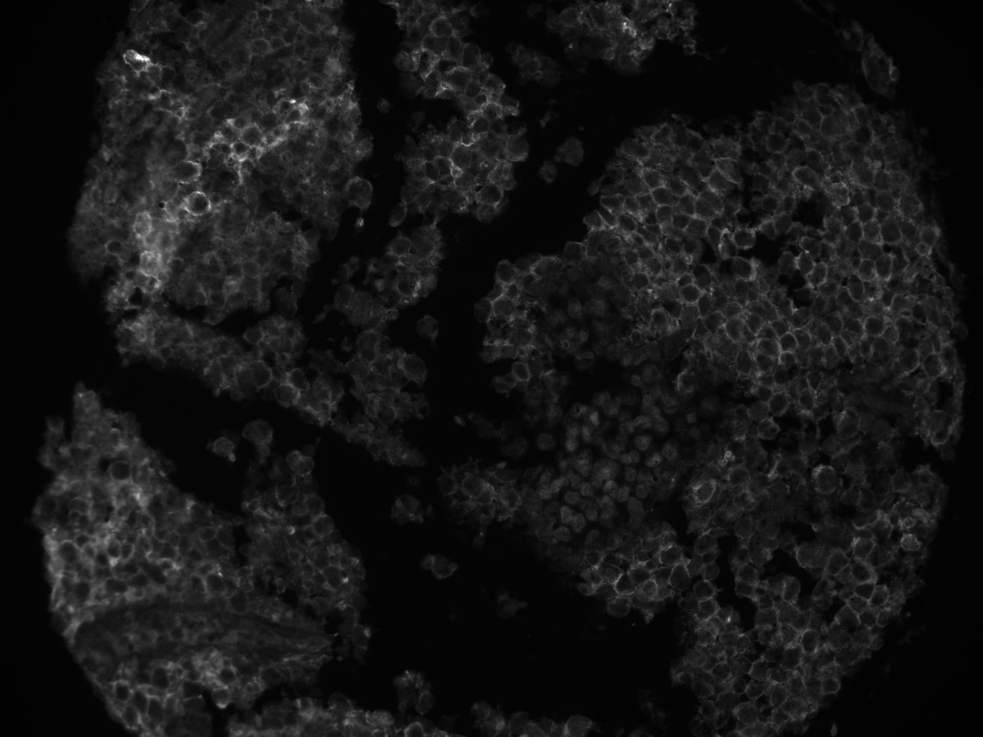 Human CXCL13/BLC/BCA‑1 Antibody AF801