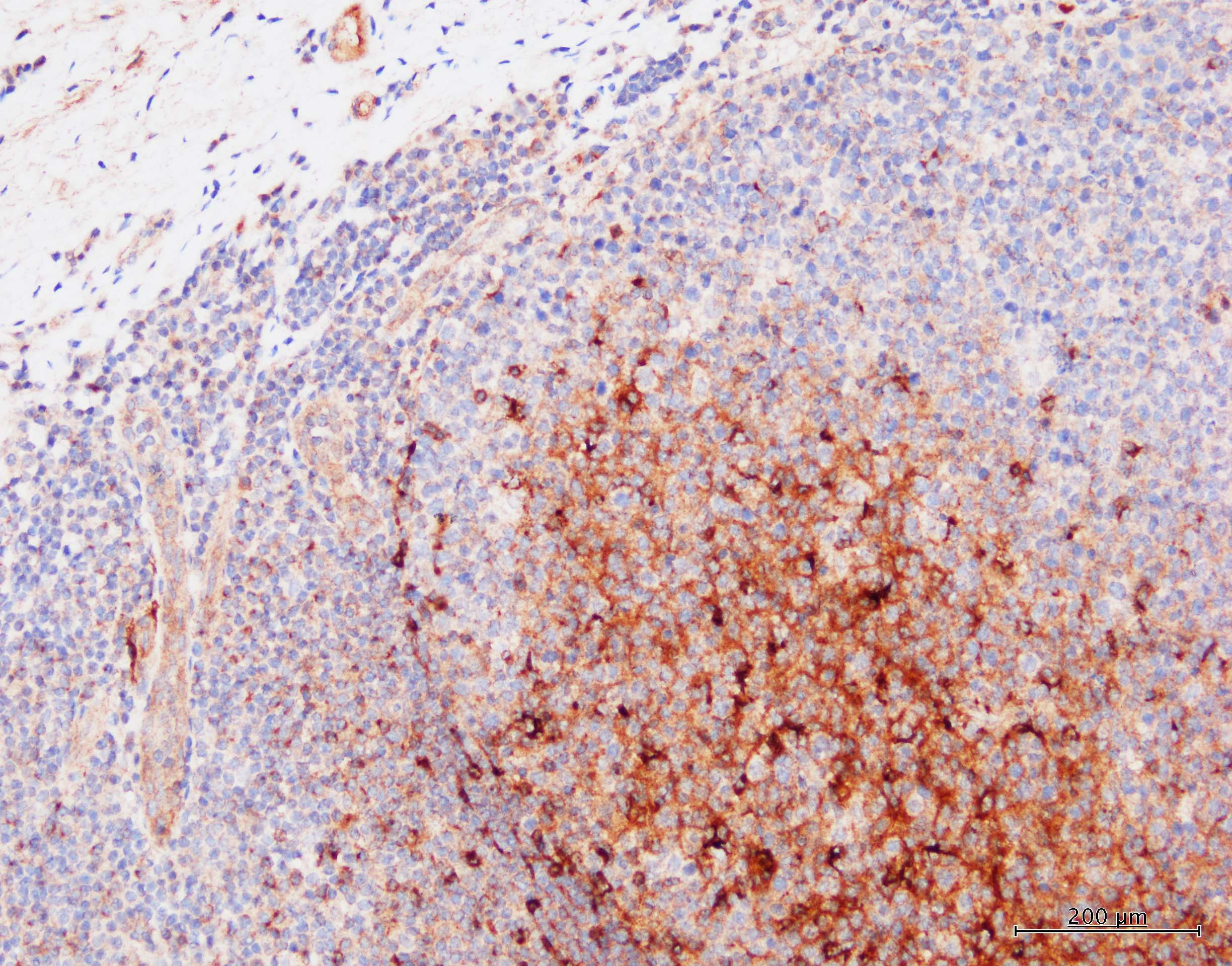 Human CXCL13/BLC/BCA‑1 Antibody AF801