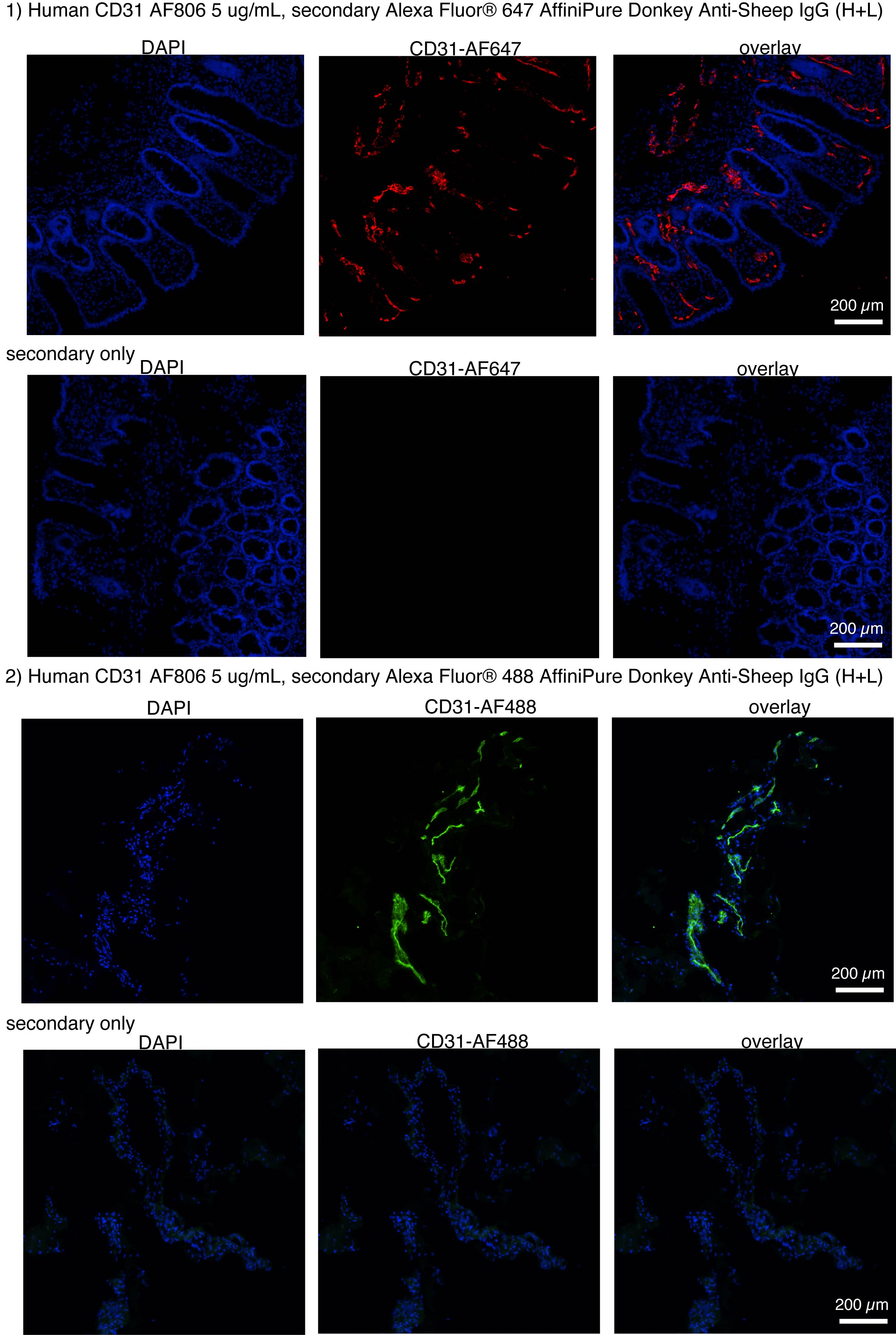 Human CD31/PECAM‑1 Antibody AF806