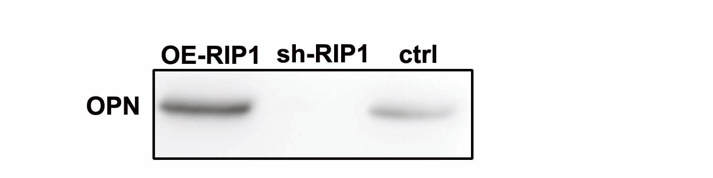 Mouse Osteopontin/OPN Antibody AF808
