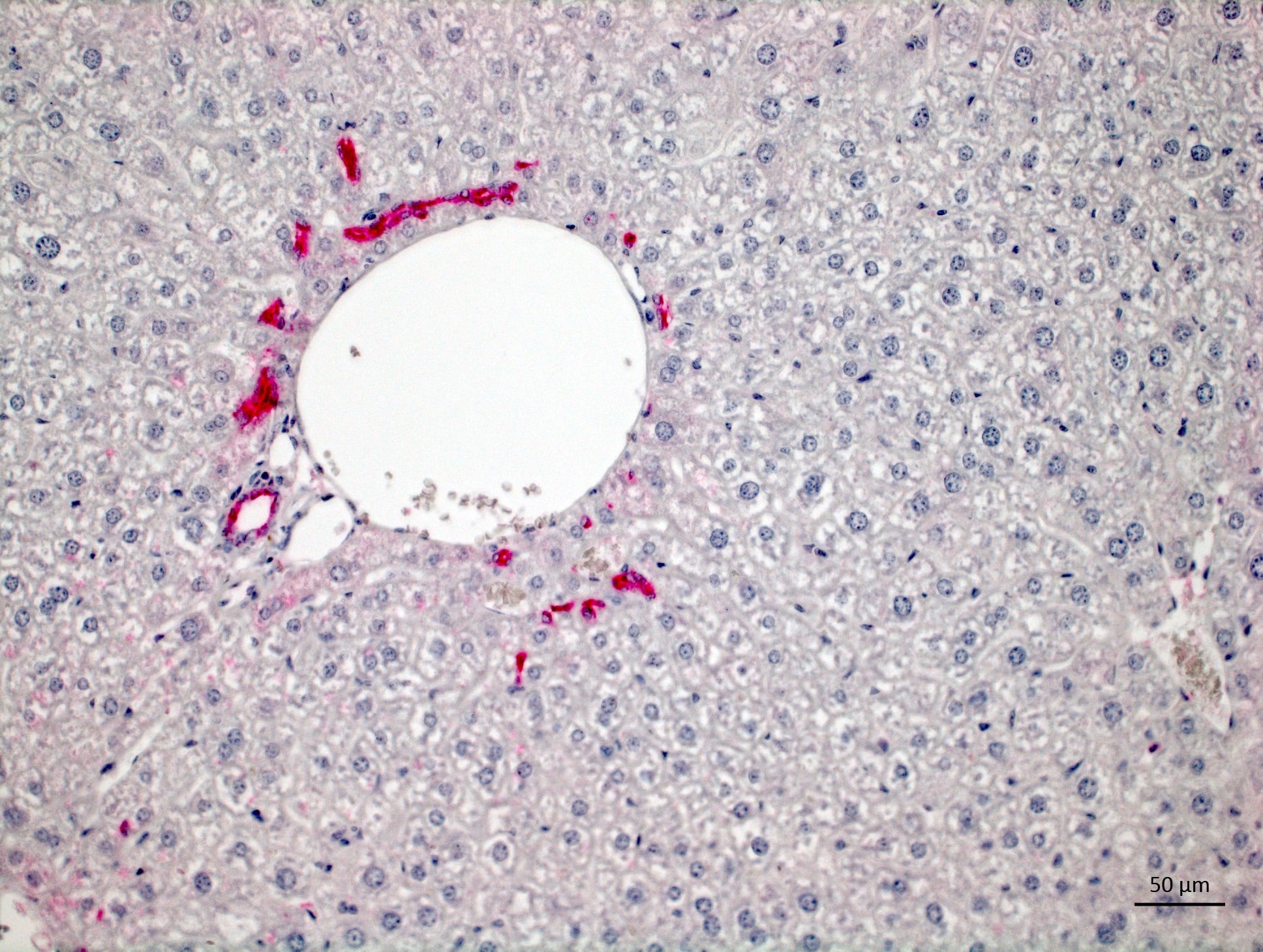 Mouse Osteopontin/OPN Antibody AF808