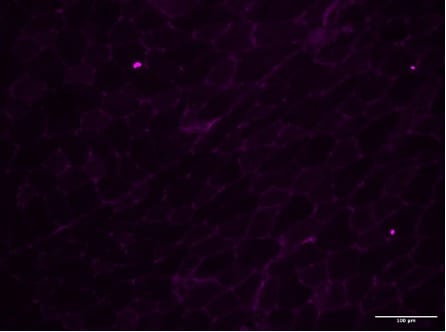 Mouse Osteopontin/OPN Antibody AF808