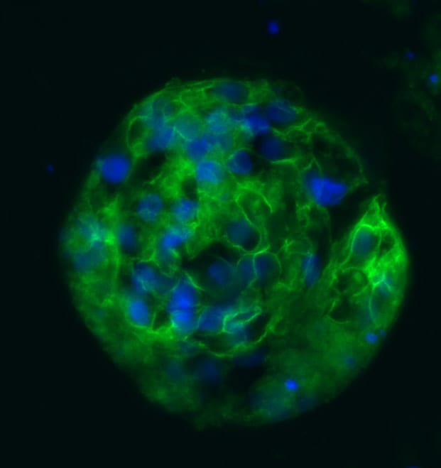 Human HCN4 Antibody AF8138