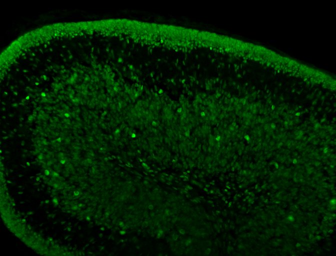Human Pax6 Antibody AF8150