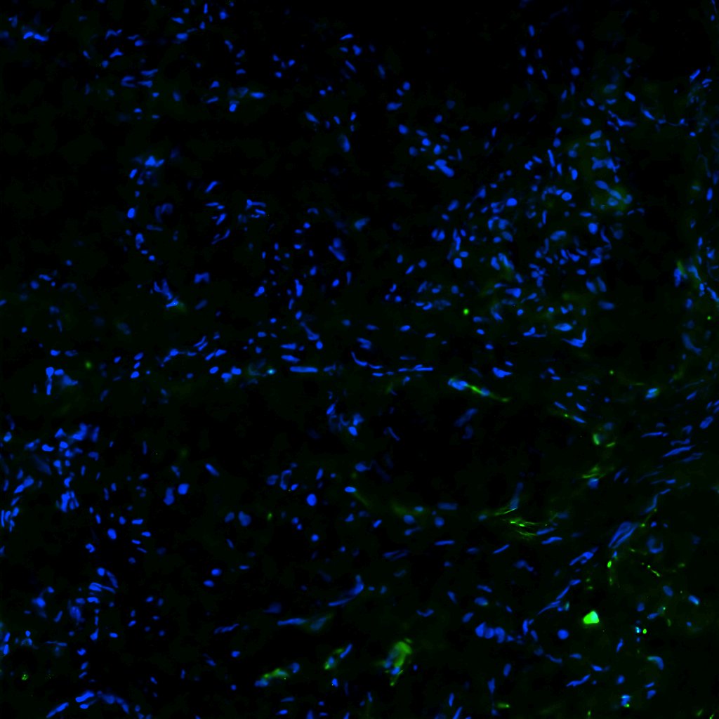 Human Chondroadherin Antibody AF8218
