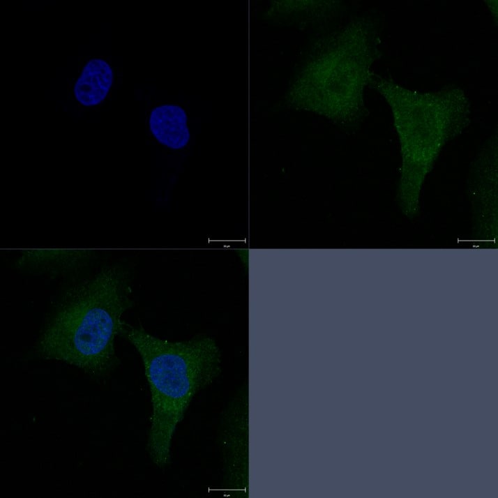 Human PSAP Antibody AF8520