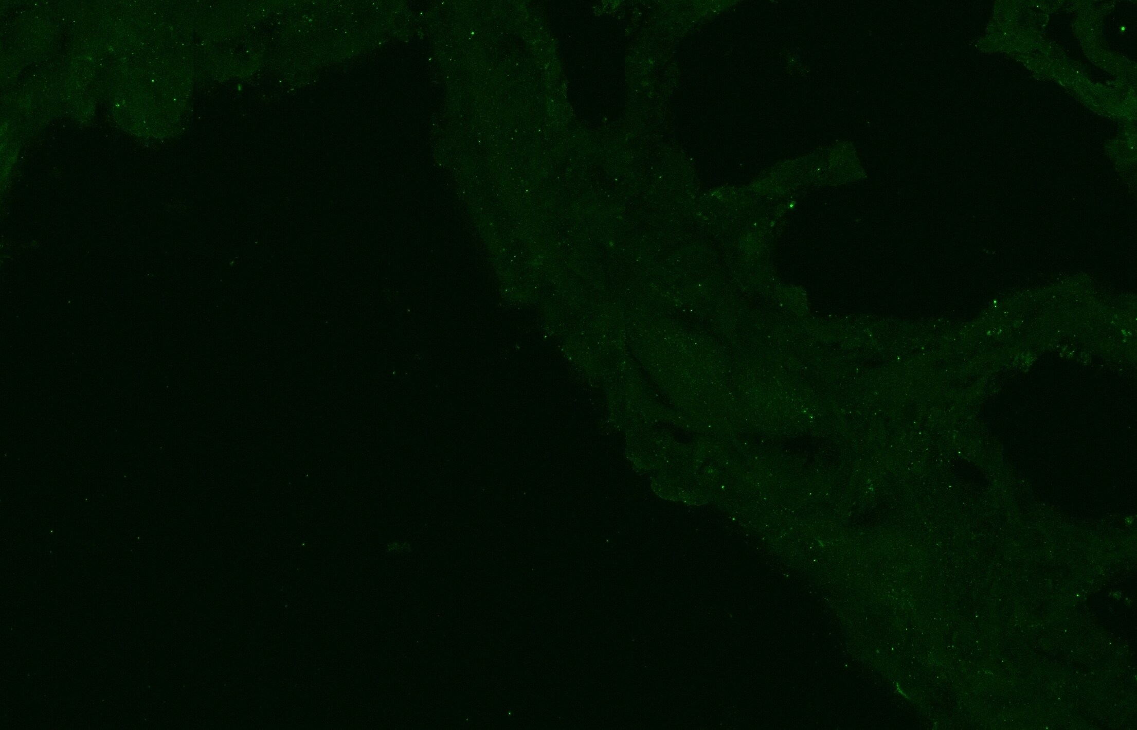 Human IGFBP‑6 Antibody AF876