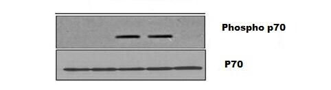 Human p70 S6 Kinase Antibody AF8962