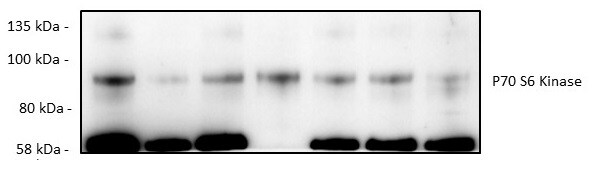 Human p70 S6 Kinase Antibody AF8962