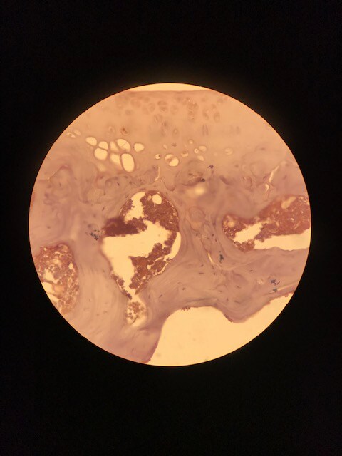 Human MMP‑1 Antibody AF901