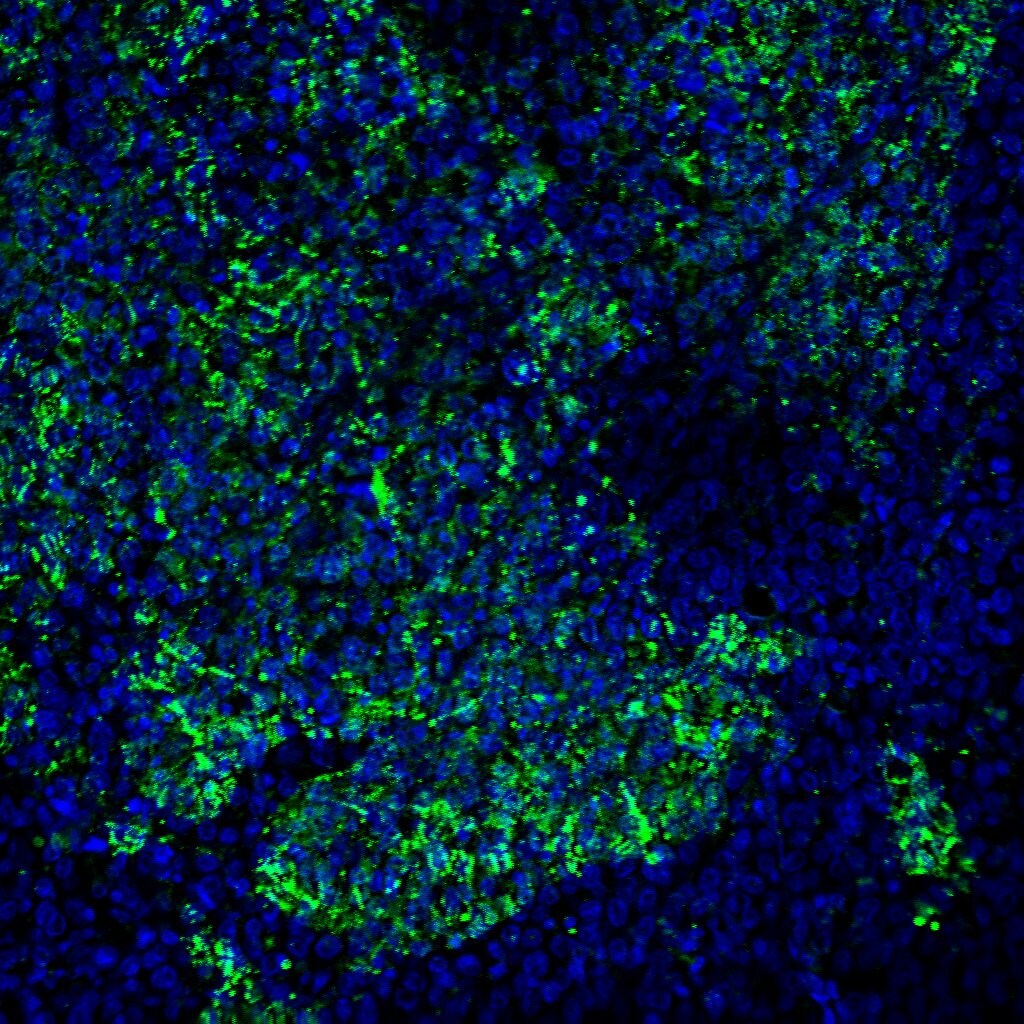 Human Common  beta  Chain Antibody AF906