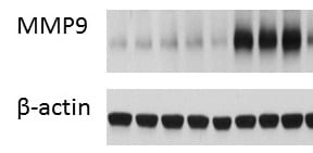 Mouse MMP‑9 Antibody AF909