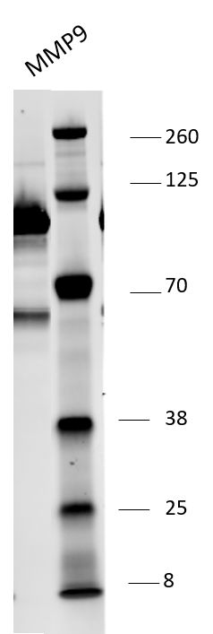 Human MMP‑9 Antibody AF911