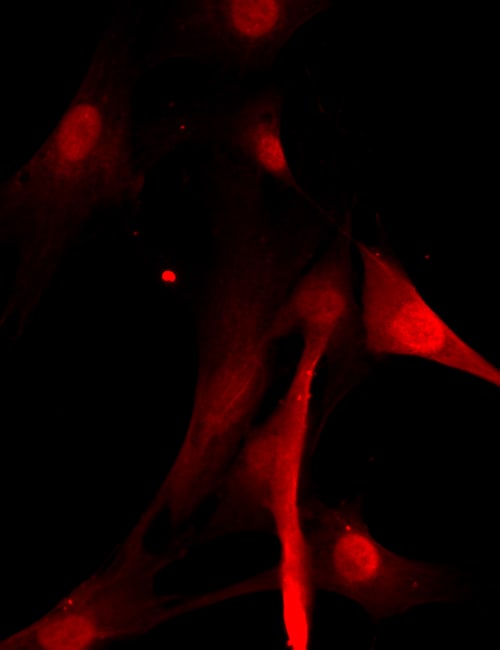 Human BAMBI/NMA Antibody AF921