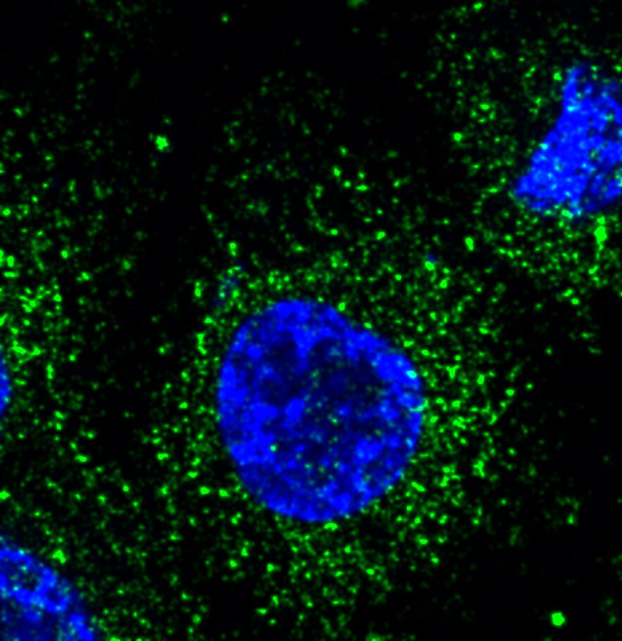 Human TACE/ADAM17 Antibody AF9301
