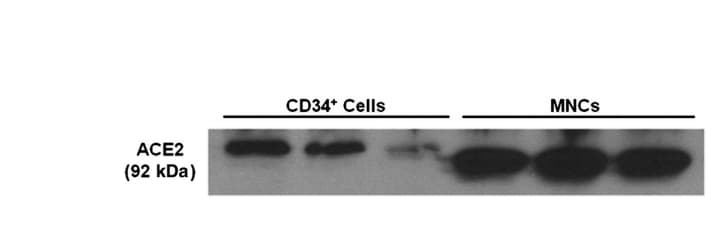 Human/Mouse/Rat/Hamster ACE‑2 Antibody AF933