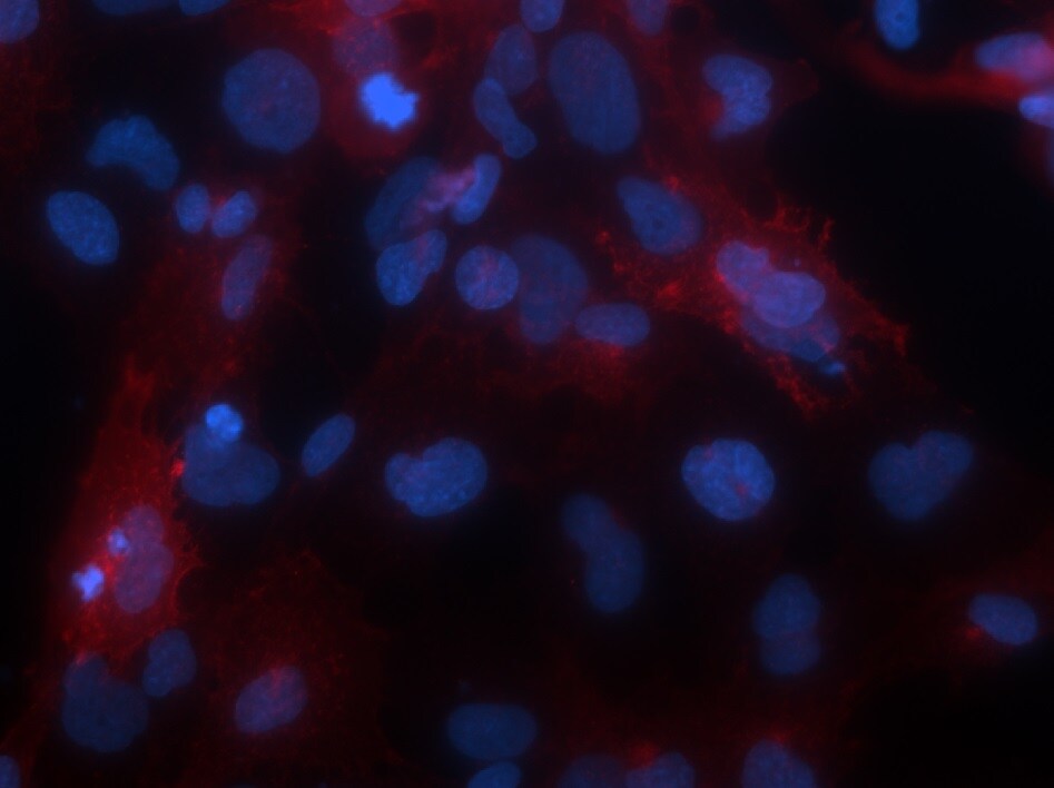 Human/Mouse/Rat/Hamster ACE‑2 Antibody AF933