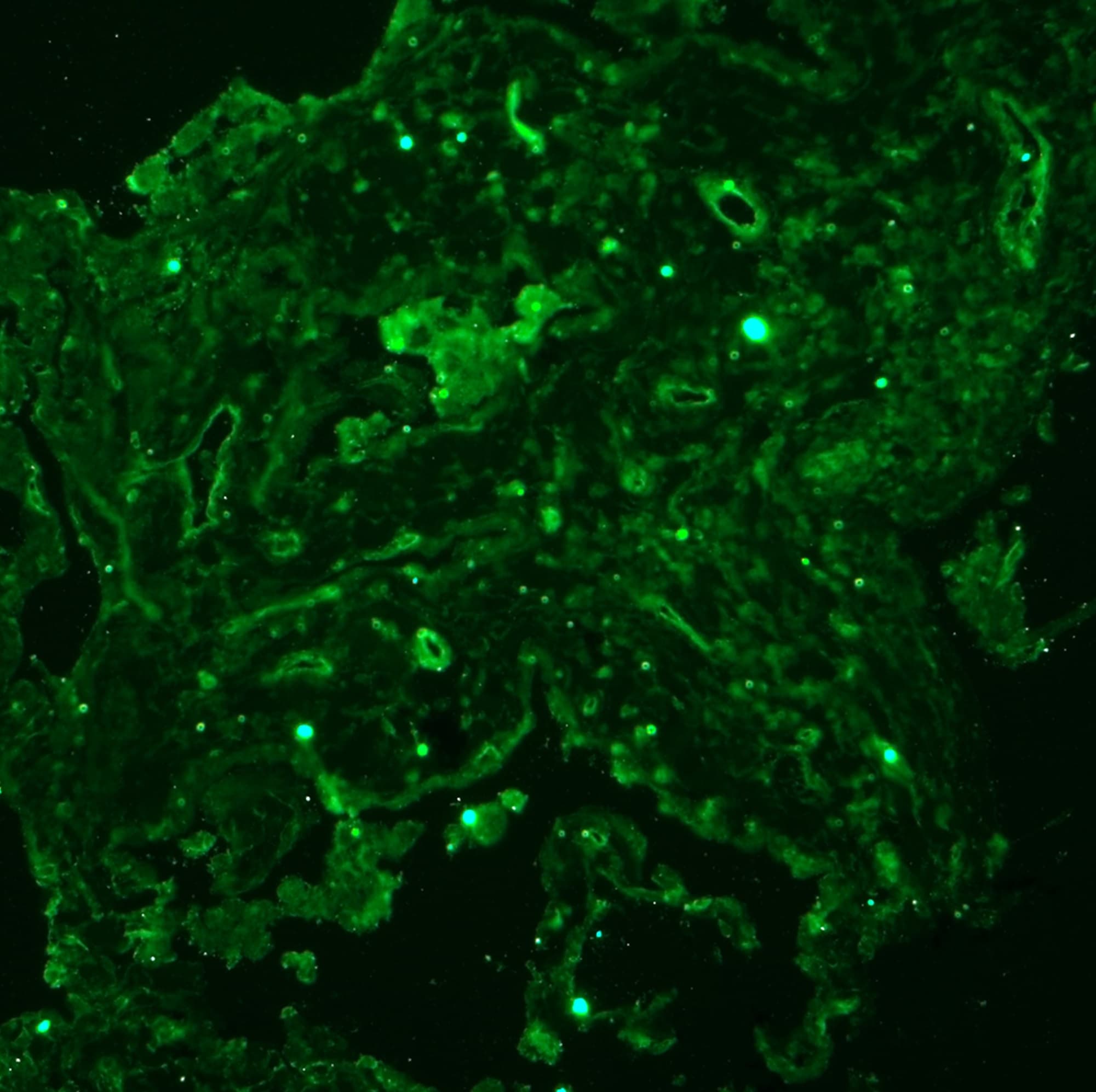 Human ADAM15 Ectodomain Antibody AF935