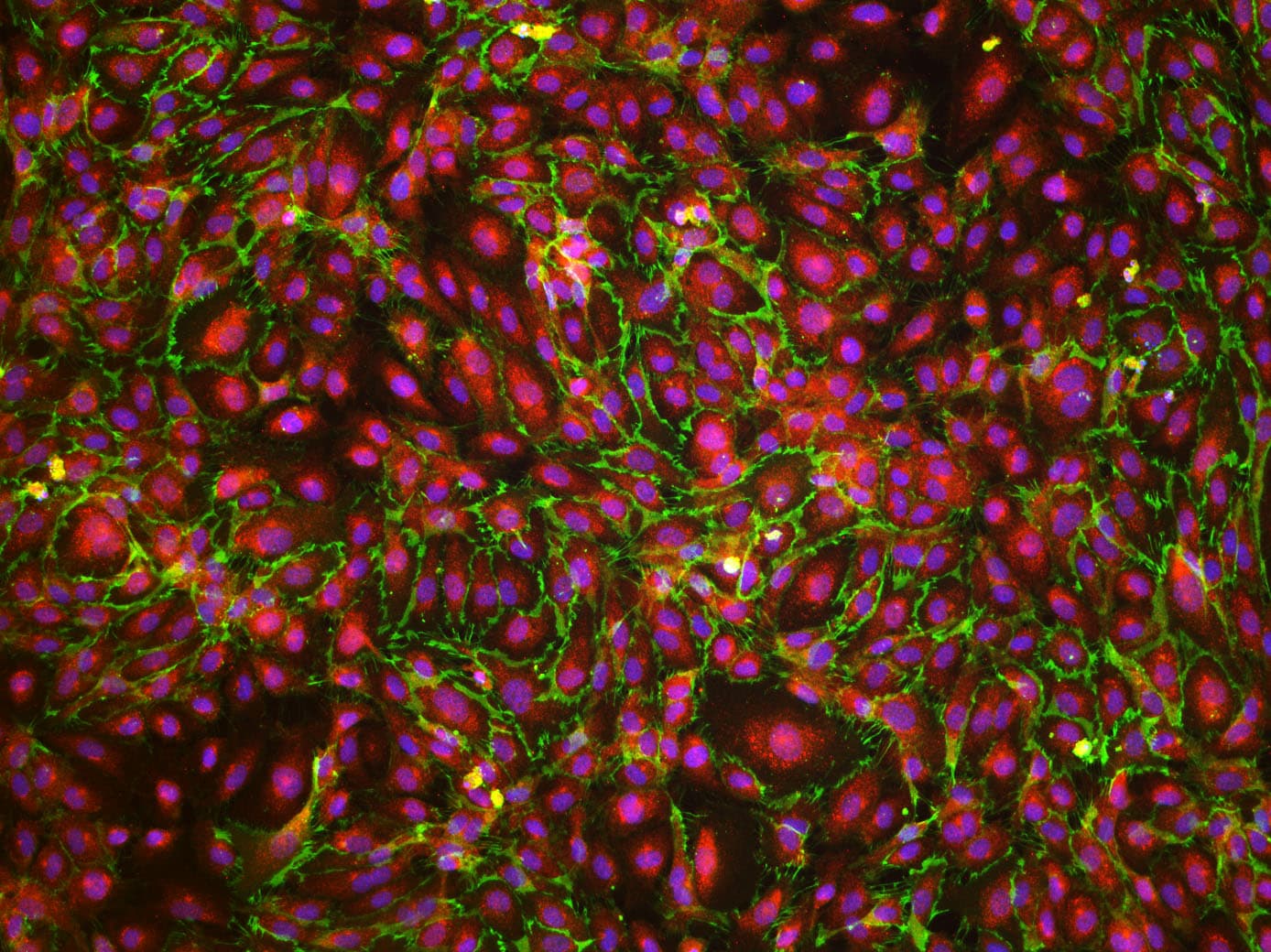 Human VE‑Cadherin Antibody AF938