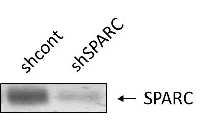 Human SPARC Antibody AF941