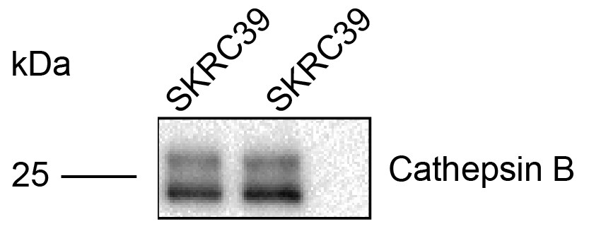 Human Cathepsin B Antibody AF953
