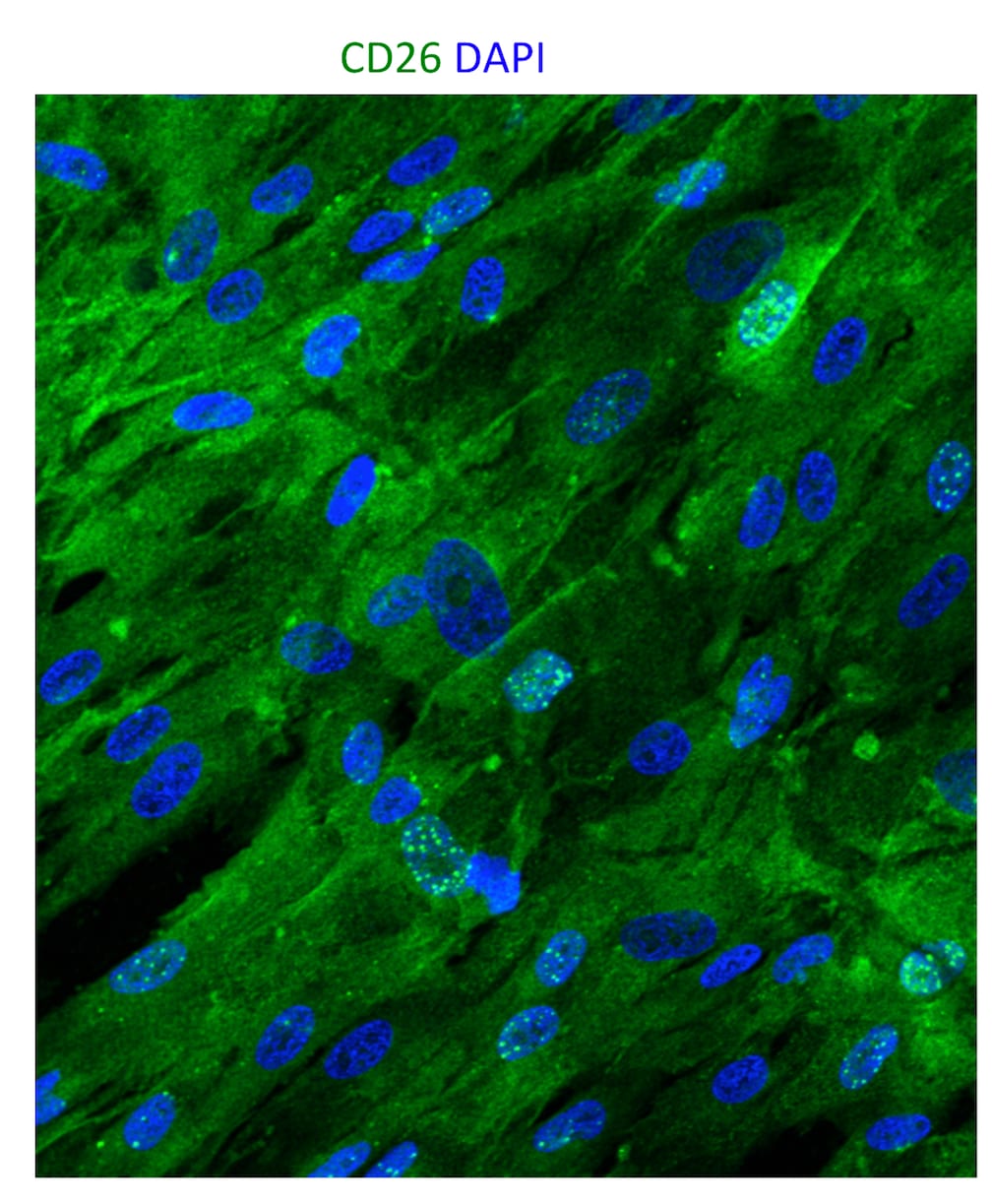 Mouse DPPIV/CD26 Antibody AF954