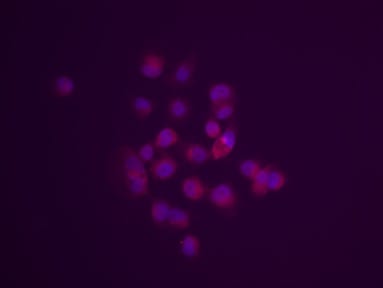 Human EpCAM/TROP‑1 Antibody AF960