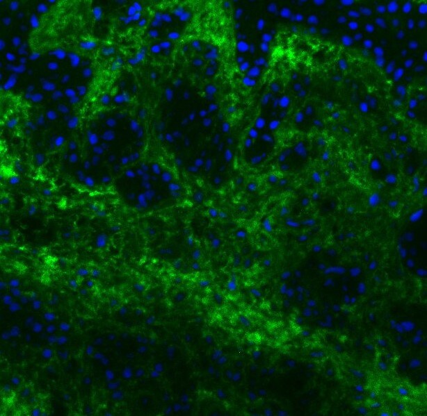 Human TIMP‑1 Antibody AF970