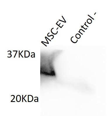 Human TIMP‑1 Antibody AF970
