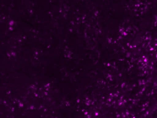 Human/Mouse TIMP‑2 Antibody AF971