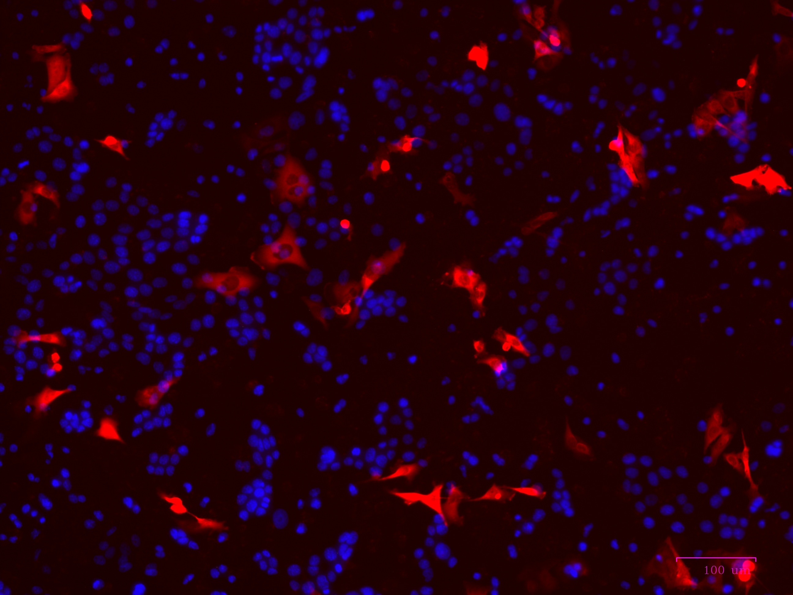 Human/Primate CXCL16 Antibody AF976