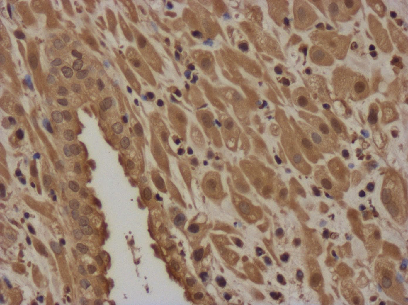 Mouse TIMP‑1 Antibody AF980