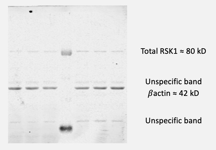 Human/Mouse/Rat RSK1 Antibody AF992