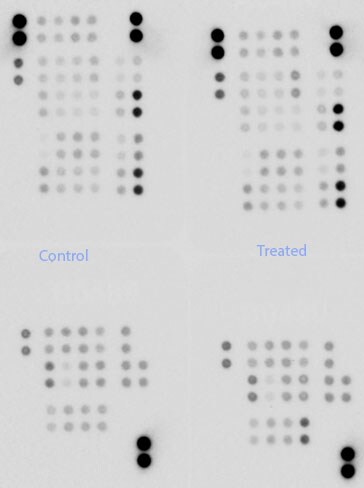 Proteome Profiler Human Phospho-Kinase Array Kit ARY003B