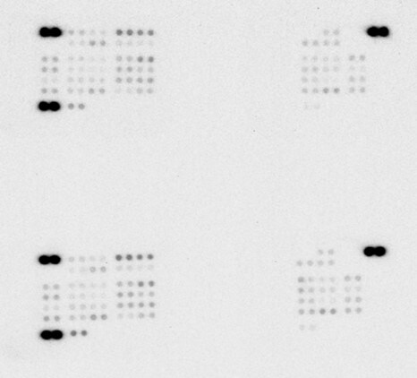 Proteome Profiler Human Phospho-Kinase Array Kit ARY003B