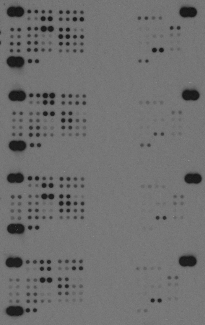 Proteome Profiler Human Phospho-Kinase Array Kit ARY003B