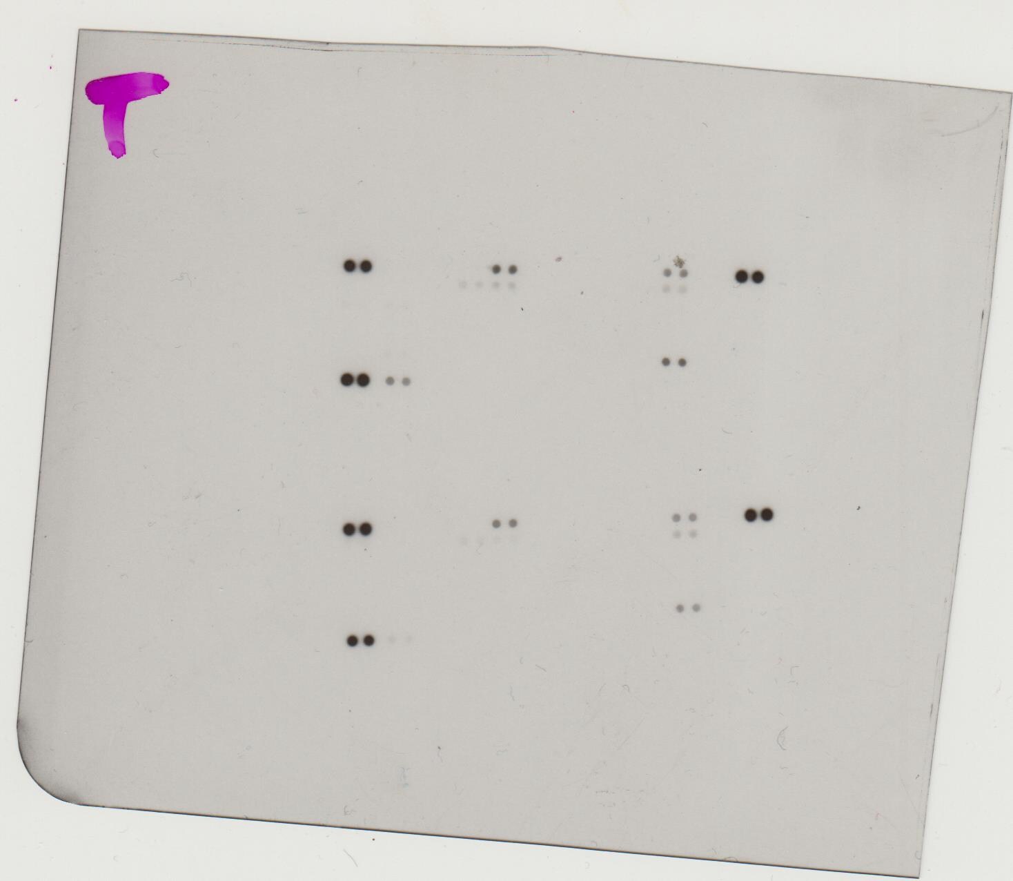 Proteome Profiler Human Phospho-Kinase Array Kit ARY003B