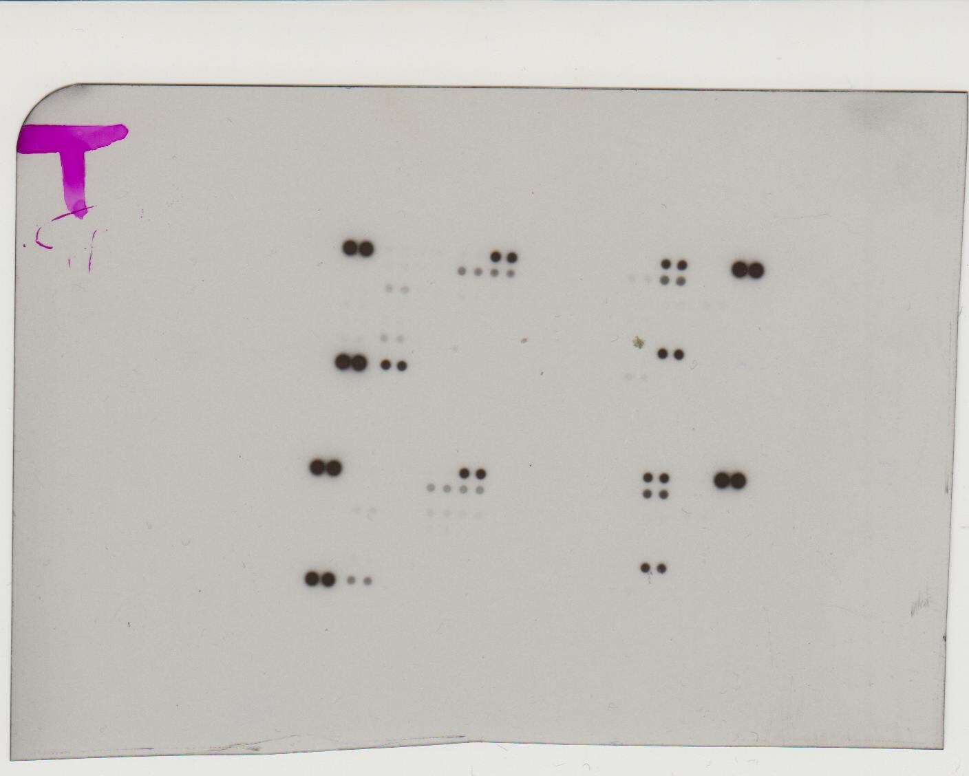 Proteome Profiler Human Phospho-Kinase Array Kit ARY003B