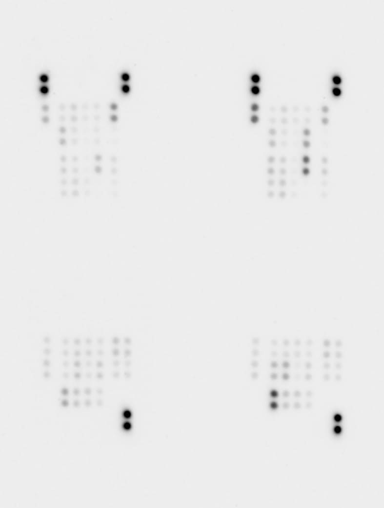 Proteome Profiler Human Phospho-Kinase Array Kit ARY003C