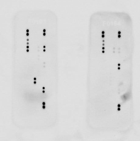 Proteome Profiler Human Cytokine Array Kit ARY005B