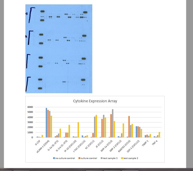 Proteome Profiler Mouse Cytokine Array Kit, Panel A ARY006