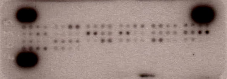 Proteome Profiler Mouse Cytokine Array Kit, Panel A ARY006