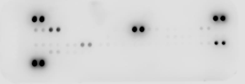 Proteome Profiler Mouse Cytokine Array Kit, Panel A ARY006