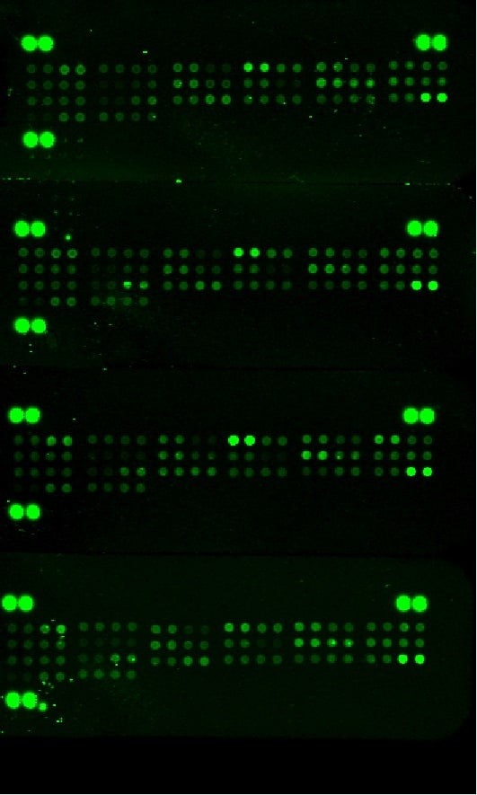 Proteome Profiler Mouse Cytokine Array Kit, Panel A ARY006