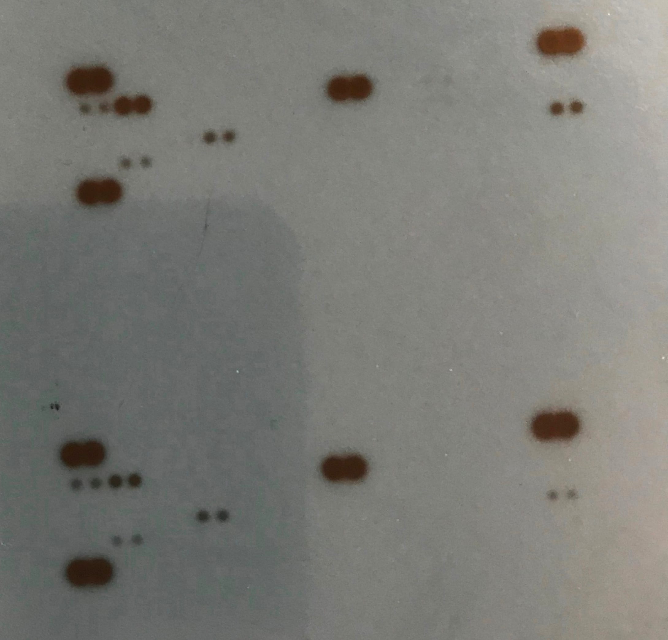 Proteome Profiler Mouse Cytokine Array Kit, Panel A ARY006