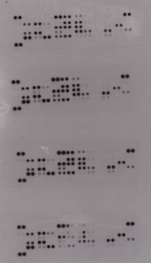 Proteome Profiler Human Angiogenesis Array Kit ARY007