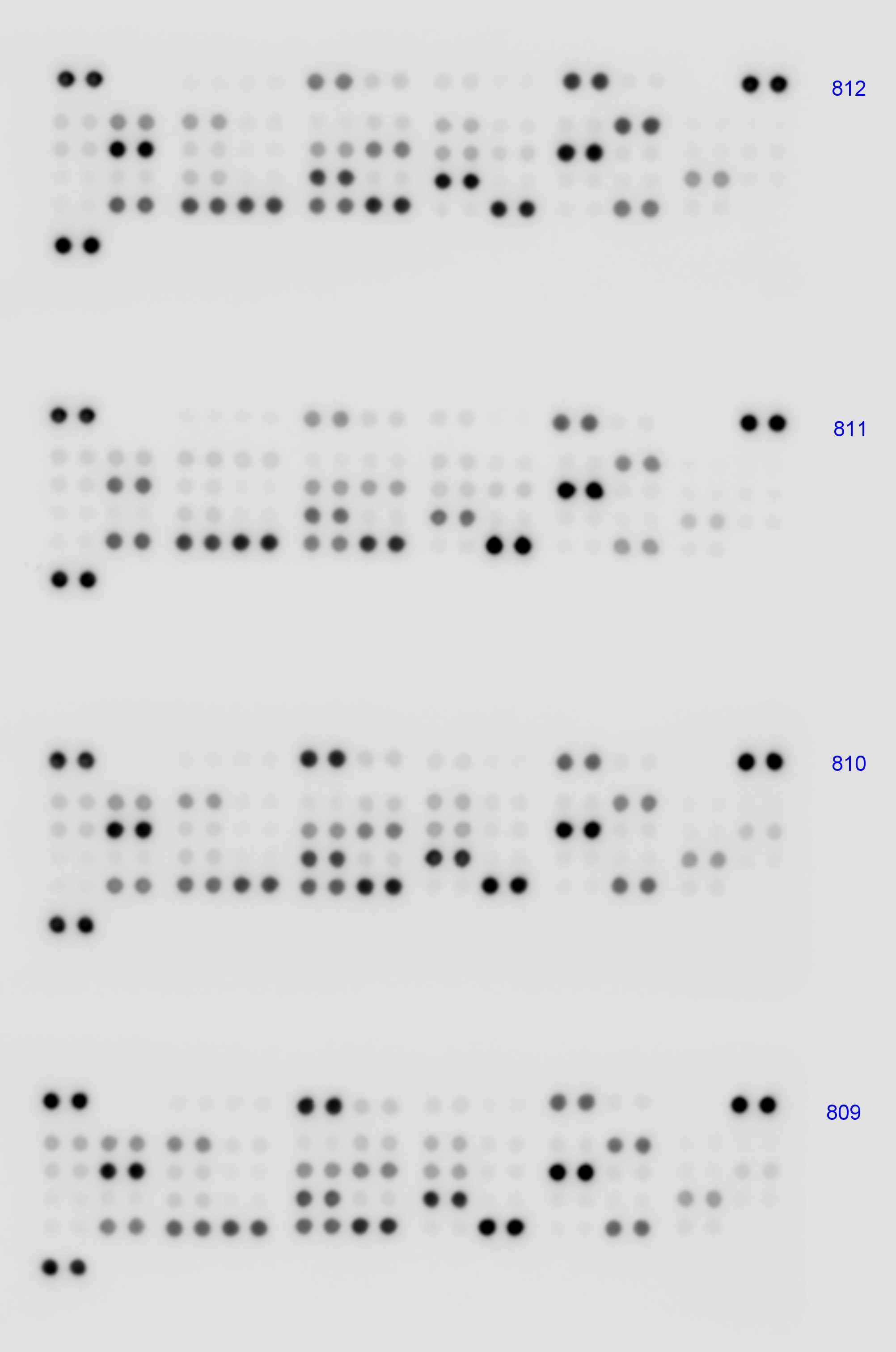 Proteome Profiler Human Angiogenesis Array Kit ARY007