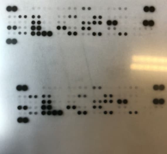 Proteome Profiler Human Angiogenesis Array Kit ARY007