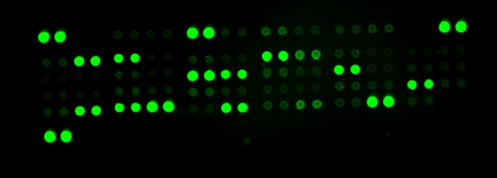 Proteome Profiler Human Angiogenesis Array Kit ARY007